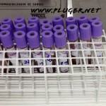 Hematologia-tubo-hemograma