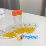 Testes e resultados de exame de laboratório