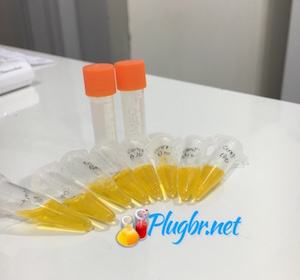 Testes e resultados de exame de laboratório