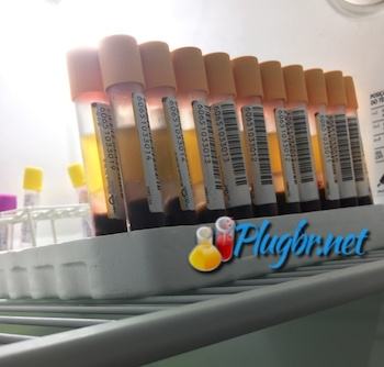 Exame de bilirrubina direta, total e indireta no sangue