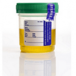 muco oxalato de cálcio urina