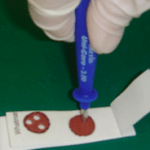 hepatite papel filtro