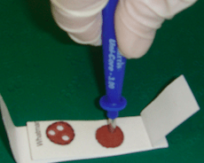 hepatite papel filtro