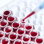 teste sangue