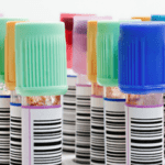 exame de sangue prolactina