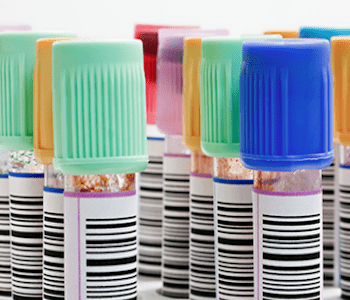 exame de sangue prolactina