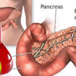 pancreas-exame-amilase-sangue