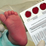 g6pd-exame-sangue-glicose