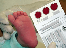 g6pd-exame-sangue-glicose