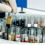 exame lkm teste laboratorial