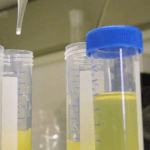 exame piócitos na urina ou fezes