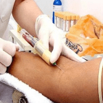 exame de sangue psa coleta e recomendações