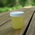 exame urina coleta da amostra