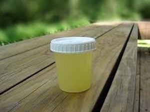 exame urina coleta da amostra