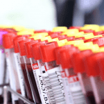 Teste exame de sangue na menstruação