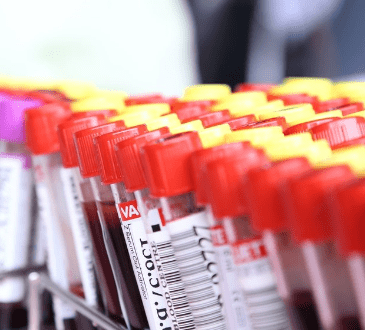 Teste exame de sangue na menstruação