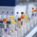 exame CEA, coleta do sangue e resultados do teste