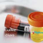Exame cloro ou cloretos, coleta sangue ou urina