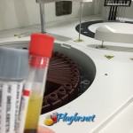 Exame de sangue fosfatase alcalina resultados normais e alterados