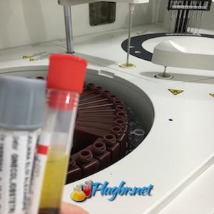 Exame de sangue fosfatase alcalina resultados normais e alterados