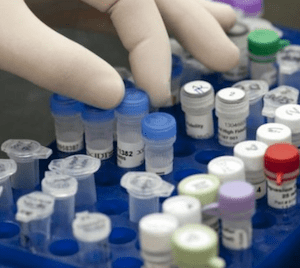 testosterona livre e total coleta de sangue e recomendações