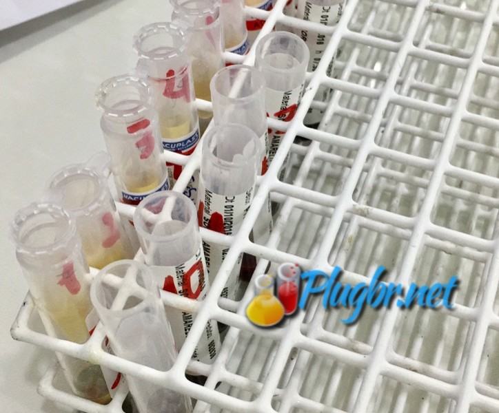 tsh exame de sangue hipo e hipertireoidismo