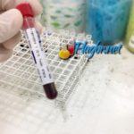 Rubéola IgG positivo