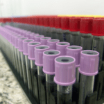 Exames de laboratório e testes de farmácia