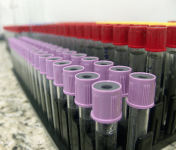 Exames de laboratório e testes de farmácia