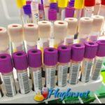 Exame de sangue coleta jejum e resultado