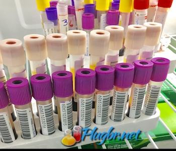 Exame de sangue coleta jejum e resultado