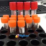 tubo exame de sangue