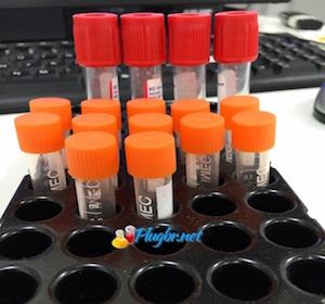 tubo exame de sangue