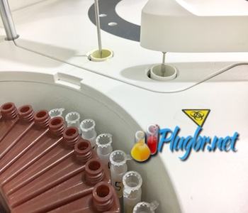 equipamento realiza exame magnésio veja resultados normais e alterados