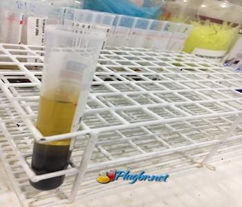 Exame Paracoccidioidomicose ou blastomicose