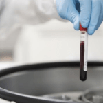 exame febre amarela diagnóstico