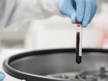 exame febre amarela diagnóstico