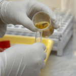 Resultado do exame de urina com fosfato ou urato amorfo