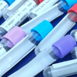 exame de sangue laboratório pregnenolona