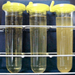 exame de urina nitrito positivo tomar medicamento