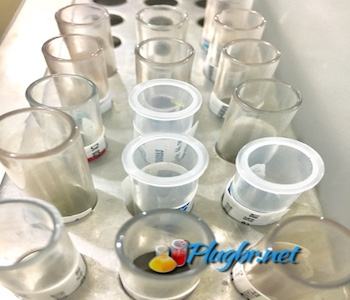 exame de sangue laboratorial anti GAD