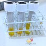 anti DNase B coleta do sangue e resultados alterados