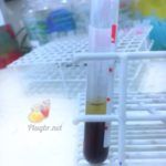 Dosagem de digoxina no sangue