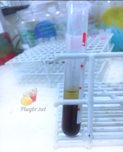 Dosagem de digoxina no sangue