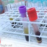 exame de sangue ige total