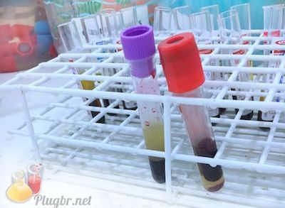 exame de sangue ige total