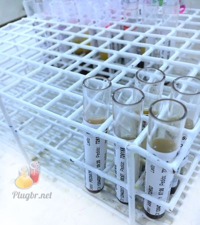 Resultado de exame de laboratório