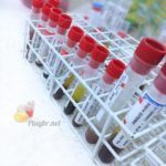 exame anti transglutaminase na doença celíaca