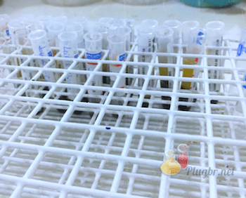 exame de sangue psa total livre e relação câncer