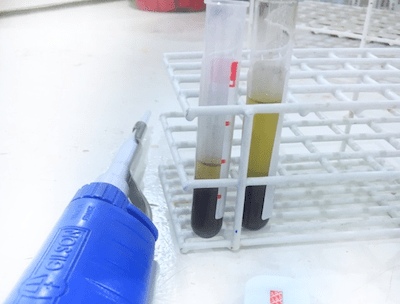 exame de sangue CA 72 4 coleta e resultado